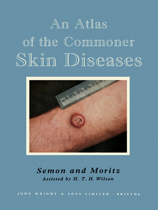 An Atlas of the Commoner Skin Diseases - Media On Demand